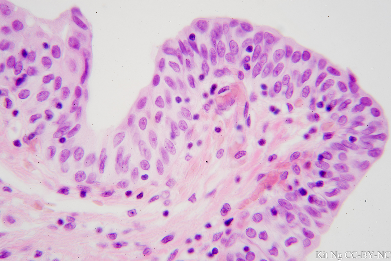Transitional Epithelium – Kit Ng, Ph.D.