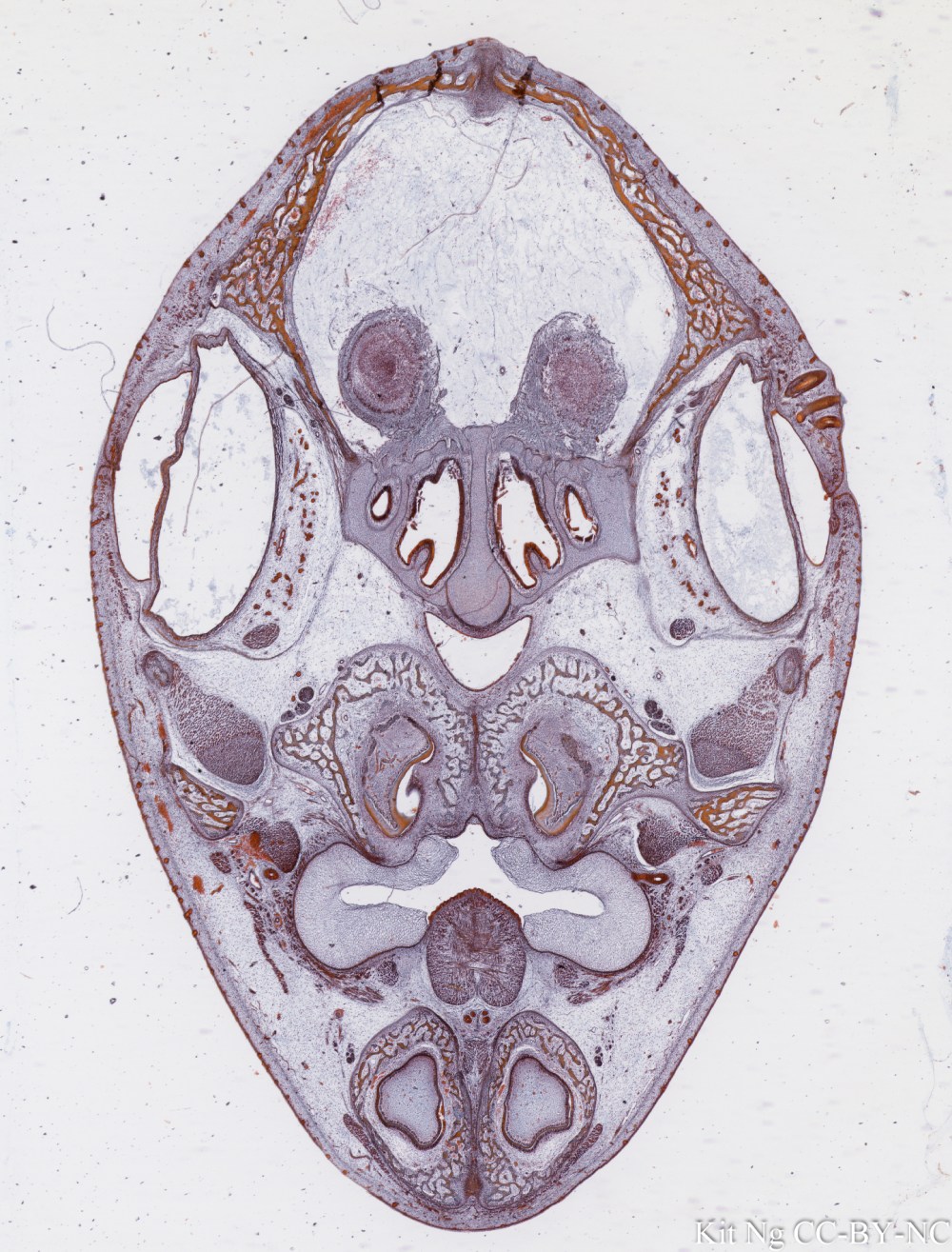 Membranous bone foetal skull.jpg