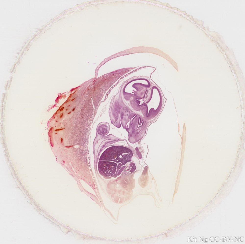 Mouse Embryo in situ
