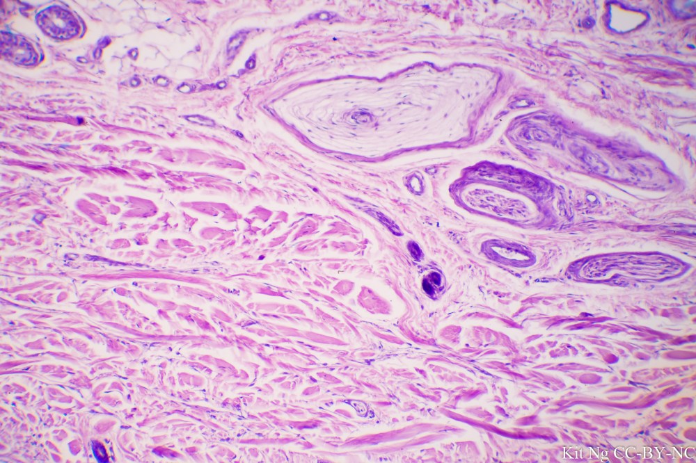 Pacinian Corpuscle.JPG
