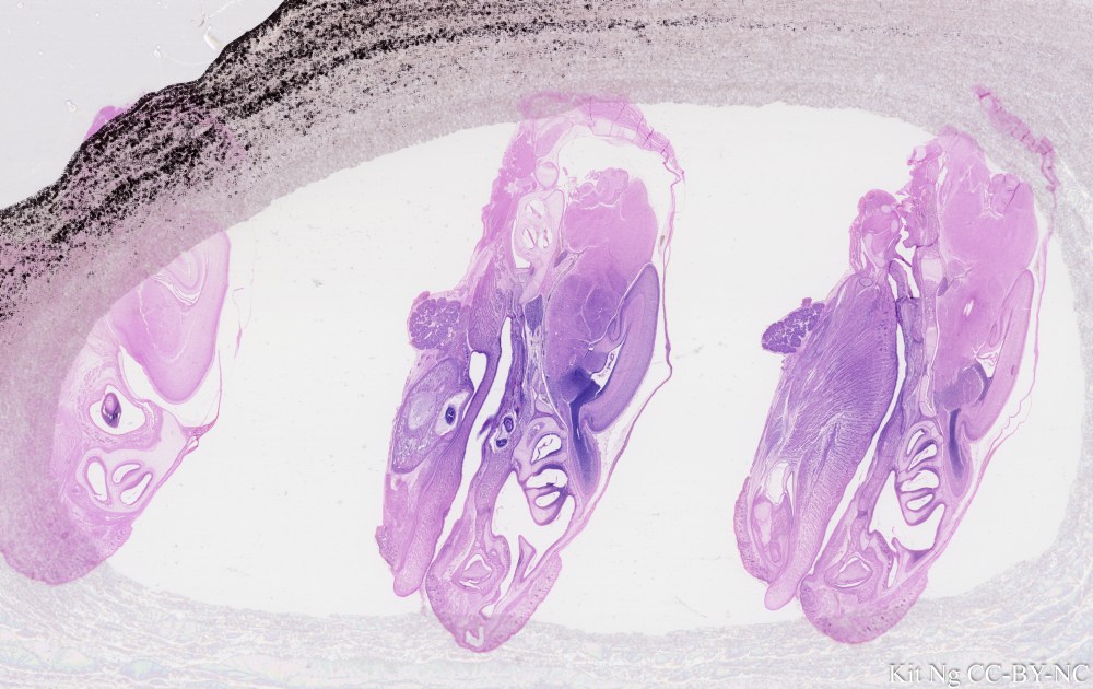 Rat Embryo head