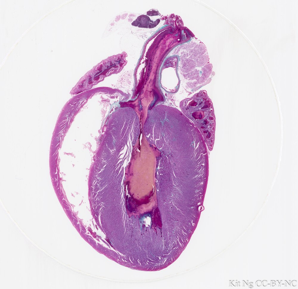 Whole Rat Heart, l.s.jpg