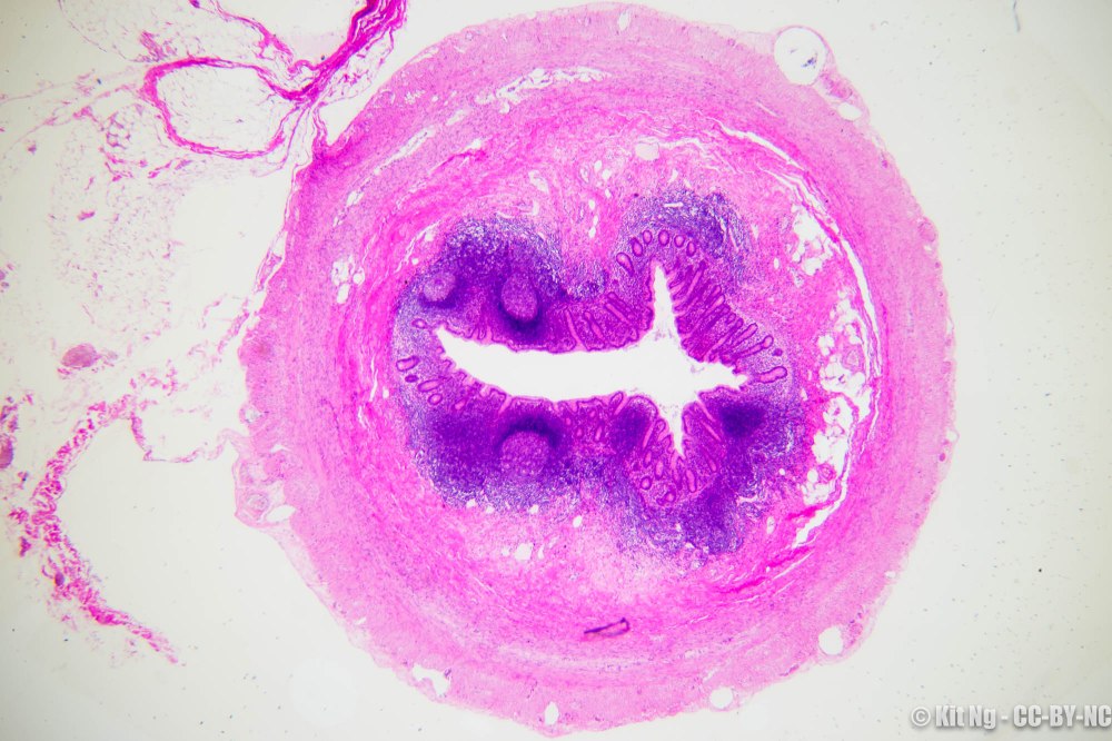 20170211_untitled_dsc6899