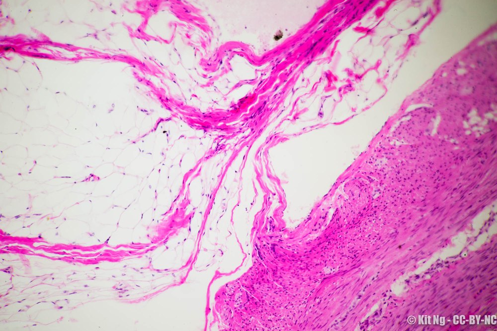 20170211_untitled_dsc6900