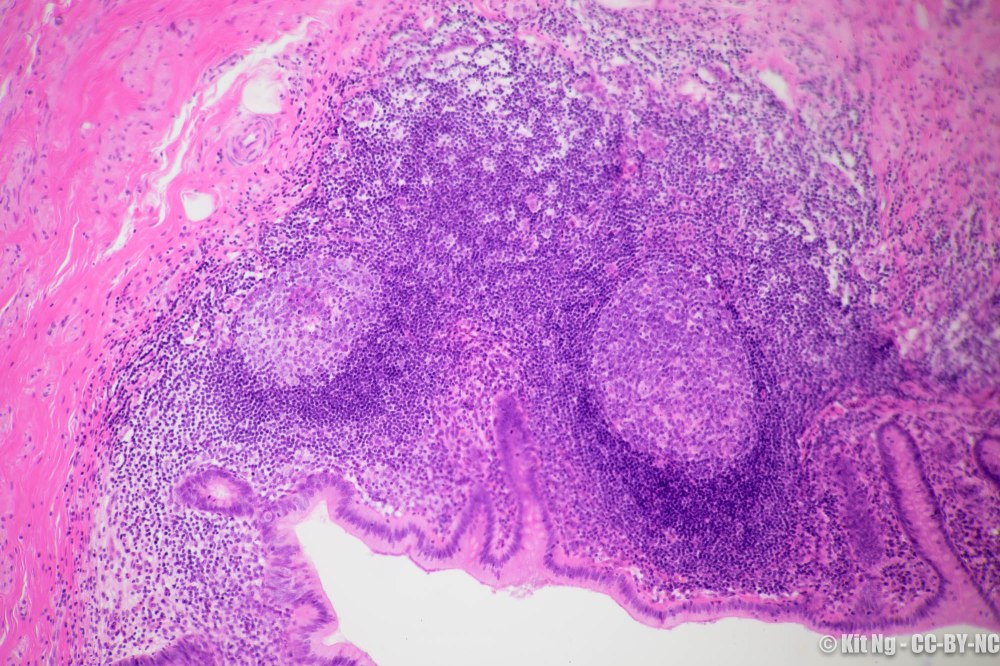 20170211_untitled_dsc6901