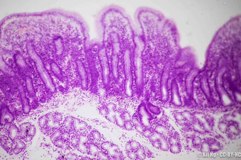 20170211_untitled_dsc6903