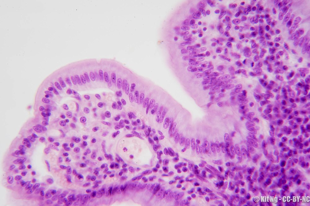 20170211_untitled_dsc6904