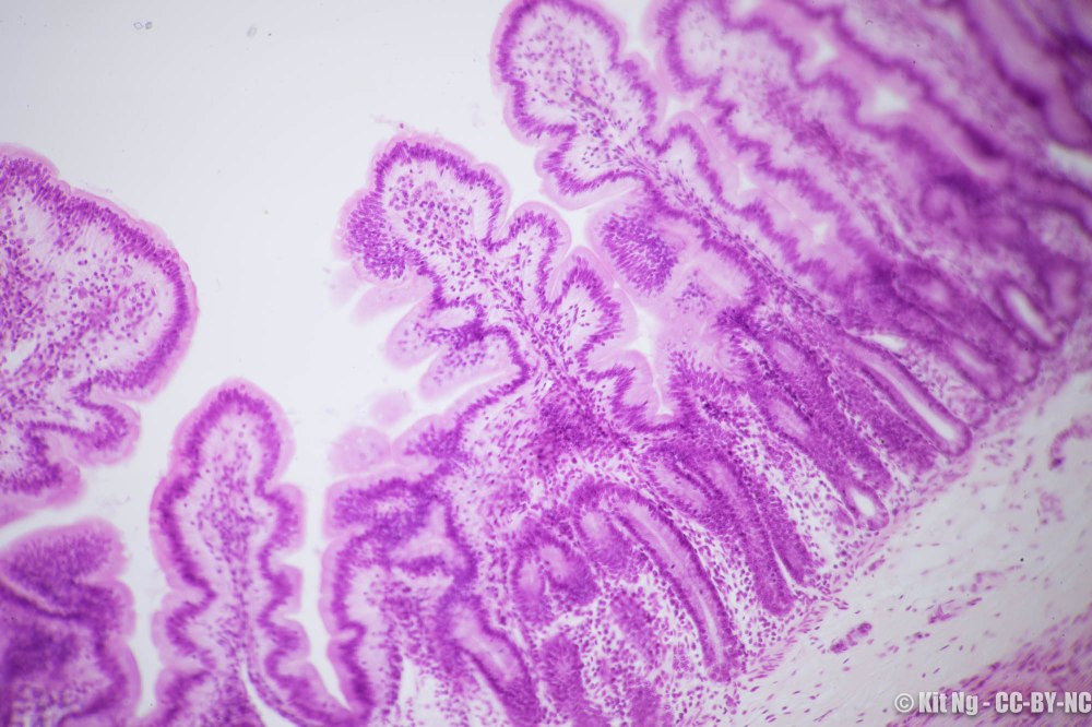 20170211_untitled_dsc6905