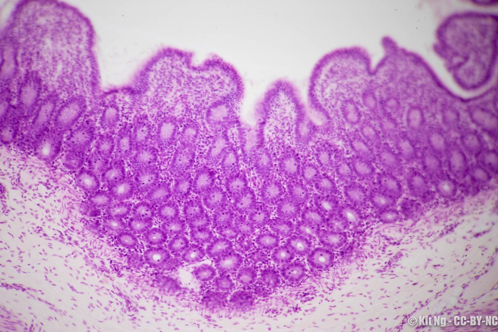 20170211_untitled_dsc6906