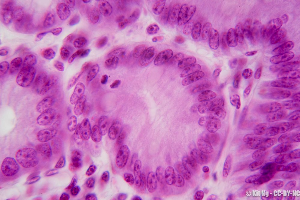 20170211_untitled_dsc6908