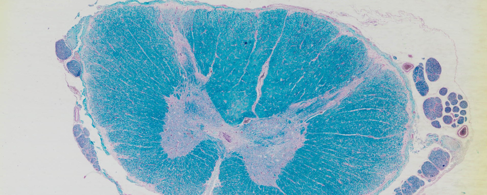 Spinal Cord (c.s.) from different regions – Kit Ng, Ph.D., image size:1920x768