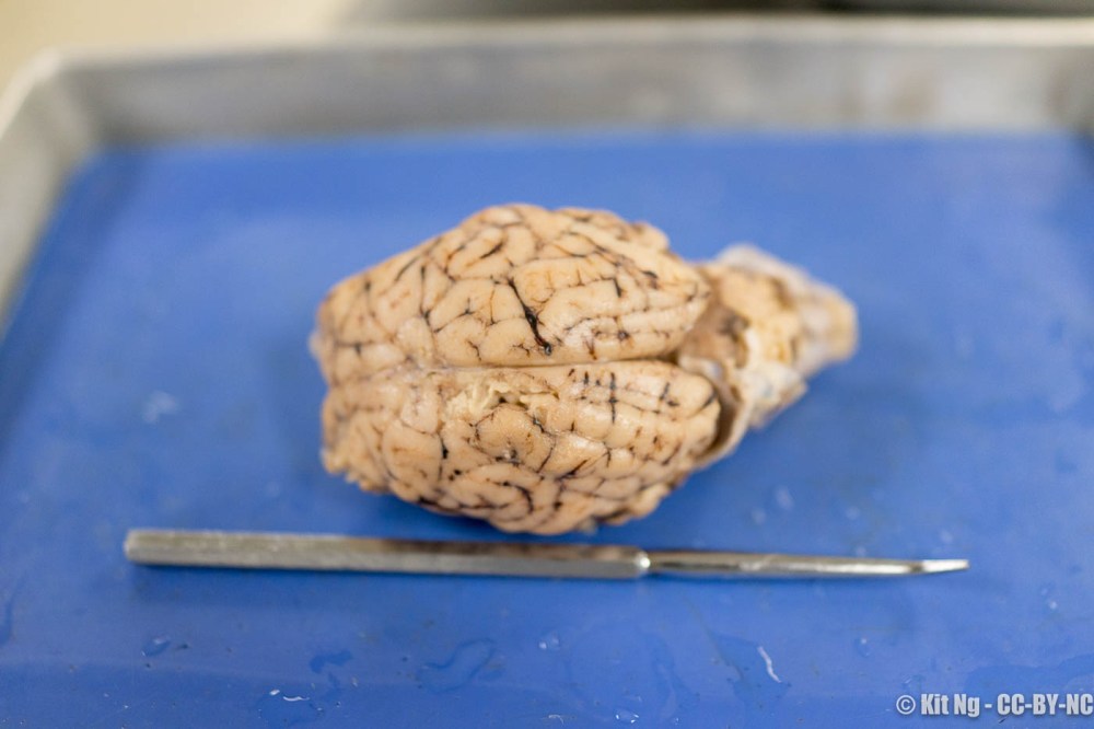 Ng_151030_microscope_2981