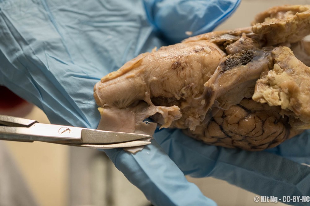 Ng_151106_microscope_3302